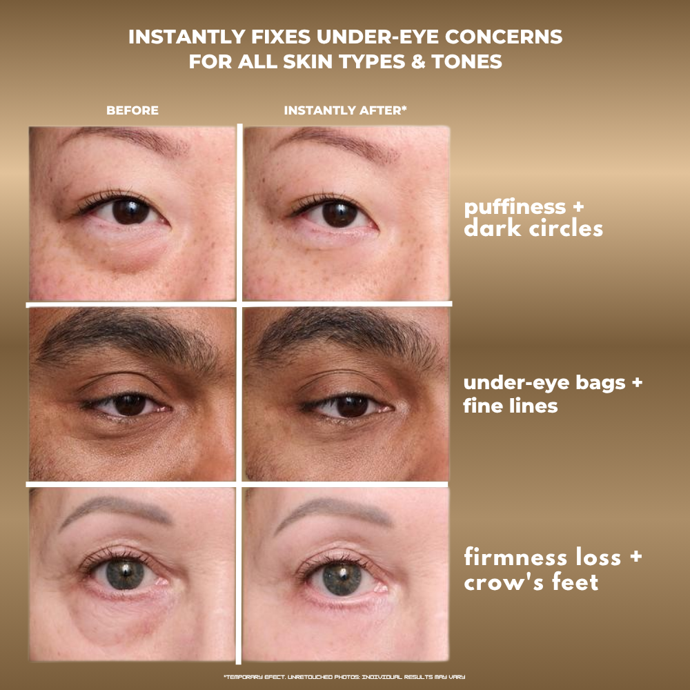 DermaRestin - Instant Eye Tightener